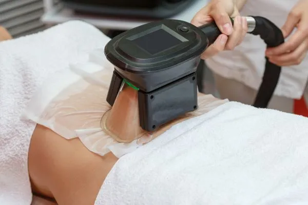 Image of person having fat freezing treatment to help weight gain Mickleover