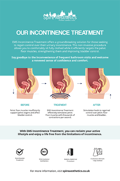 image of how urge incontinence Mickleover treatment works