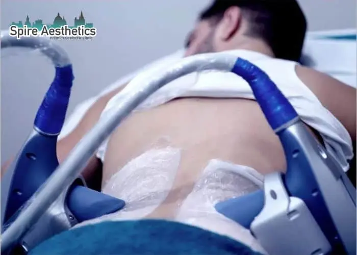 Man having fat freezing treatment done on love handles before a competitions Mickleover to create a sculpted look.